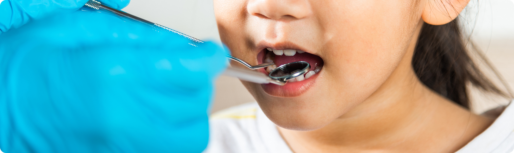 소아교정 이미지